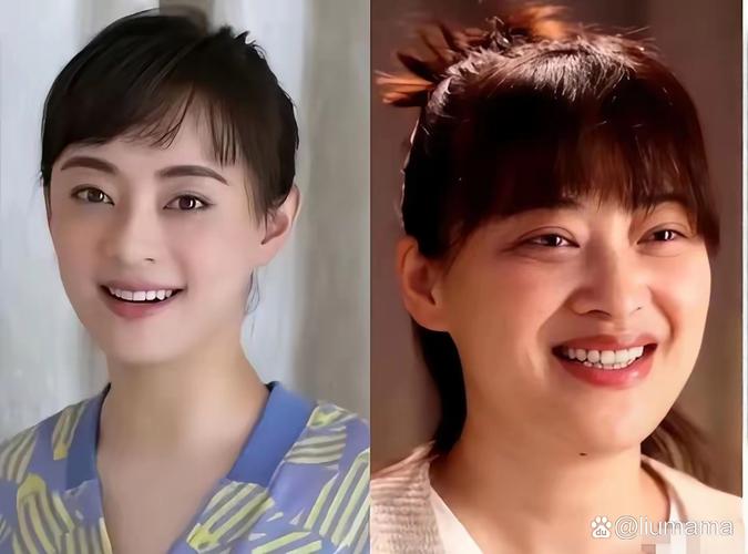 2025年新澳门天天开彩大全和孙俪唇下痣没了与孙俪嘴唇的痣