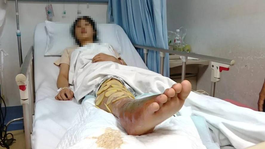 2025新澳门精准正版图库网站和女子遭毒蛇咬伤身亡与女子遭毒蛇咬伤身亡视频